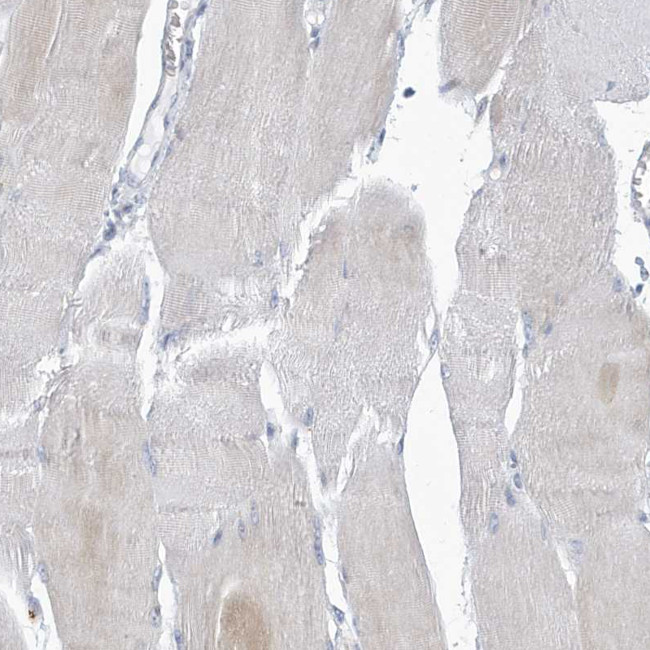 VTA1 Antibody in Immunohistochemistry (Paraffin) (IHC (P))