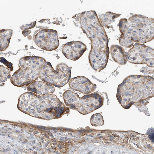 GALNTL6 Antibody in Immunohistochemistry (Paraffin) (IHC (P))