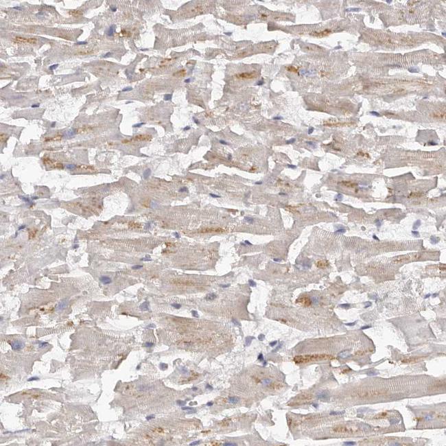 Kir6.1 (KCNJ8) Antibody in Immunohistochemistry (IHC)