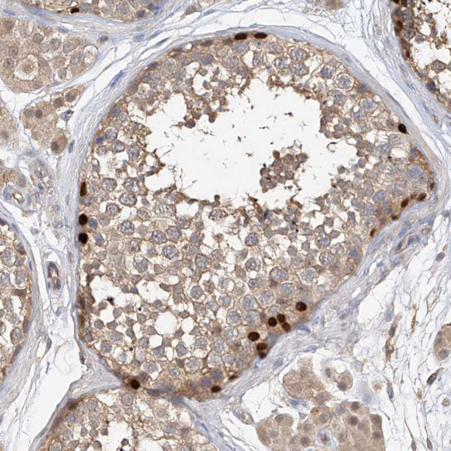 OFD1 Antibody in Immunohistochemistry (Paraffin) (IHC (P))