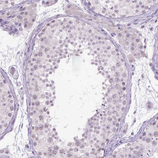 KMO Antibody in Immunohistochemistry (Paraffin) (IHC (P))