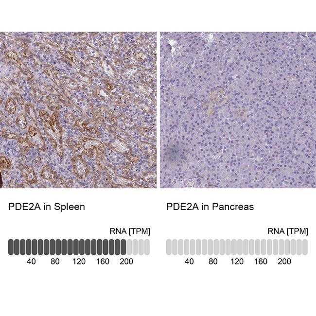 PDE2A Antibody in Immunohistochemistry (IHC)