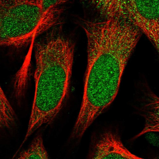 ZNF518B Antibody in Immunocytochemistry (ICC/IF)