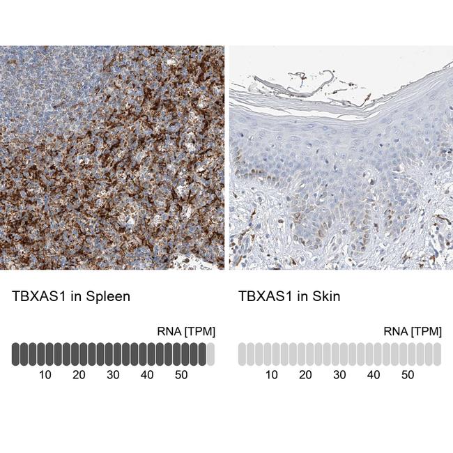 Thromboxane synthase Antibody in Immunohistochemistry (IHC)