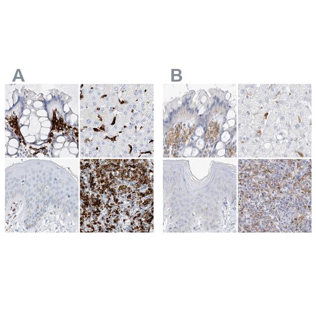 Thromboxane synthase Antibody in Immunohistochemistry (IHC)