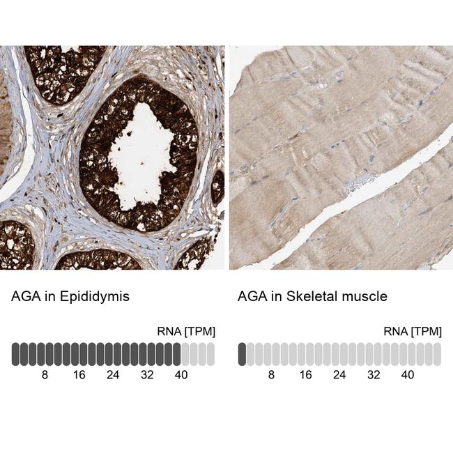 AGA Antibody in Immunohistochemistry (IHC)