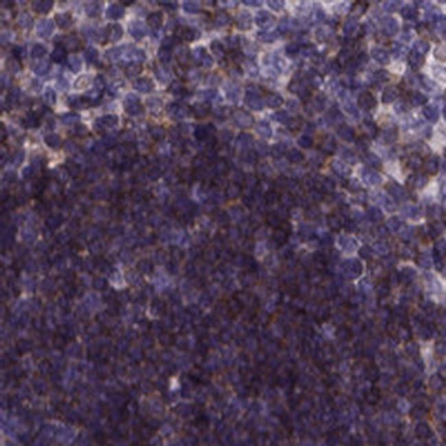 Themis Antibody in Immunohistochemistry (IHC)