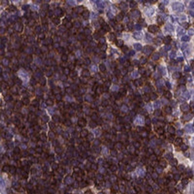 Themis Antibody in Immunohistochemistry (IHC)