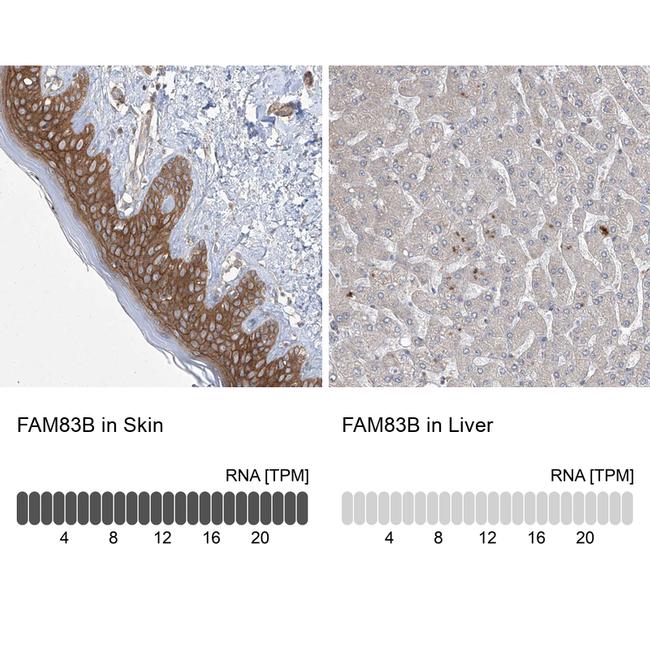 FAM83B Antibody in Immunohistochemistry (IHC)