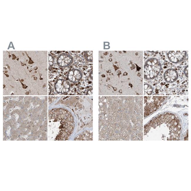 XTP3B Antibody in Immunohistochemistry (IHC)