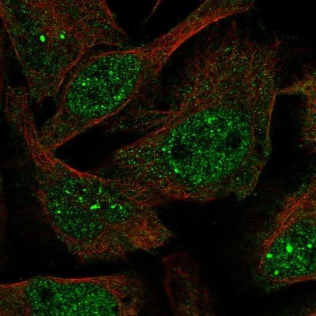 KIAA1429 Antibody in Immunocytochemistry (ICC/IF)