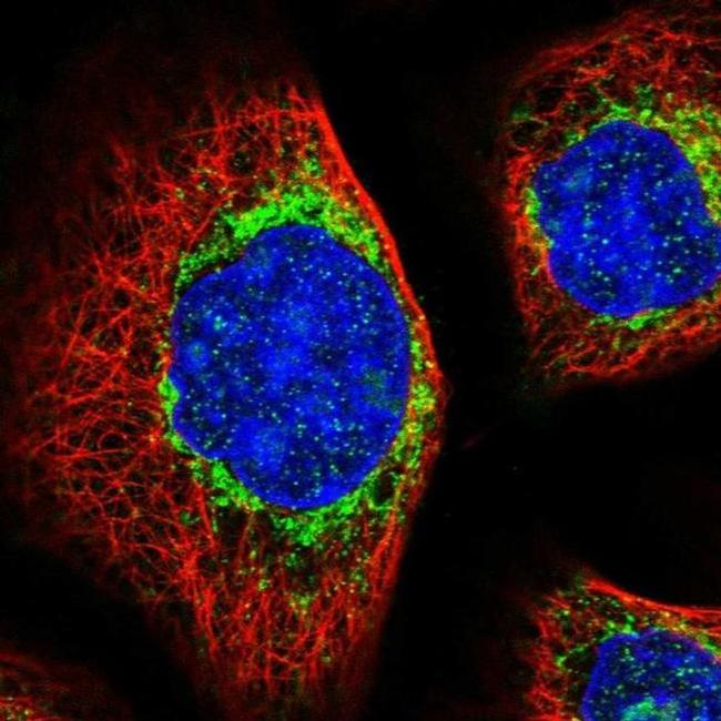 MTX2 Antibody in Immunocytochemistry (ICC/IF)