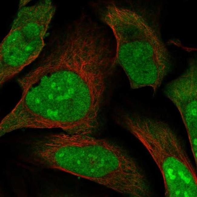 MAGED2 Antibody in Immunocytochemistry (ICC/IF)