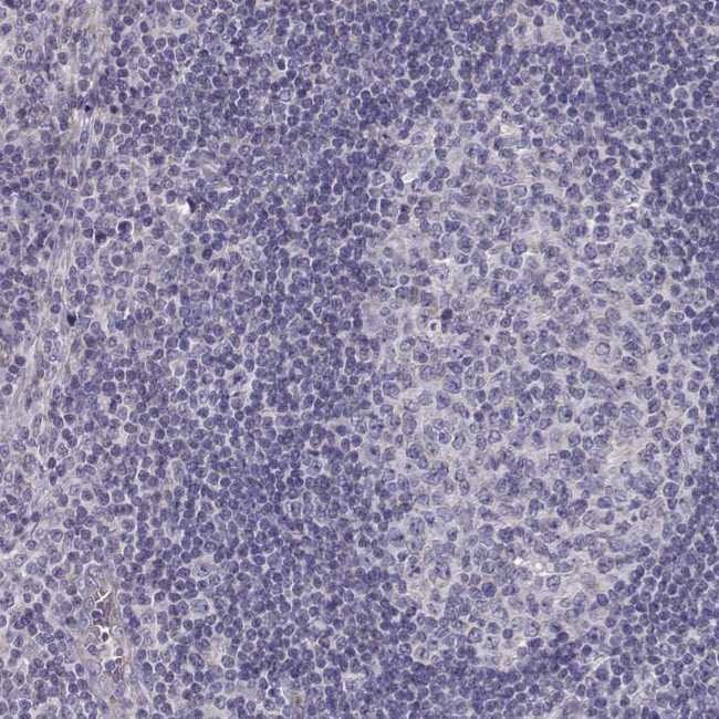 BEND6 Antibody in Immunohistochemistry (Paraffin) (IHC (P))