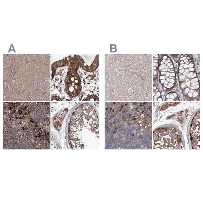 ASCC3 Antibody in Immunohistochemistry (IHC)