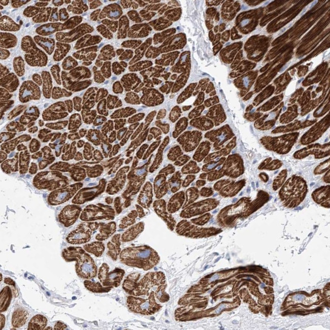 MCD Antibody in Immunohistochemistry (Paraffin) (IHC (P))