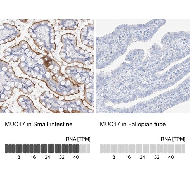 MUC17 Antibody in Immunohistochemistry (IHC)