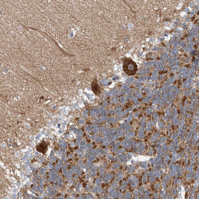 CPNE6 Antibody in Immunohistochemistry (Paraffin) (IHC (P))