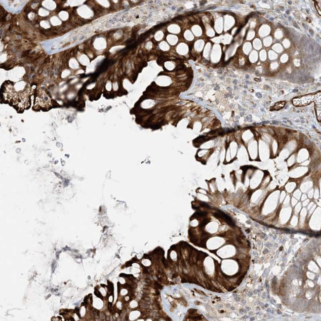 BCORL1 Antibody in Immunohistochemistry (Paraffin) (IHC (P))