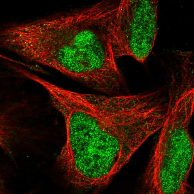 SIX4 Antibody in Immunocytochemistry (ICC/IF)