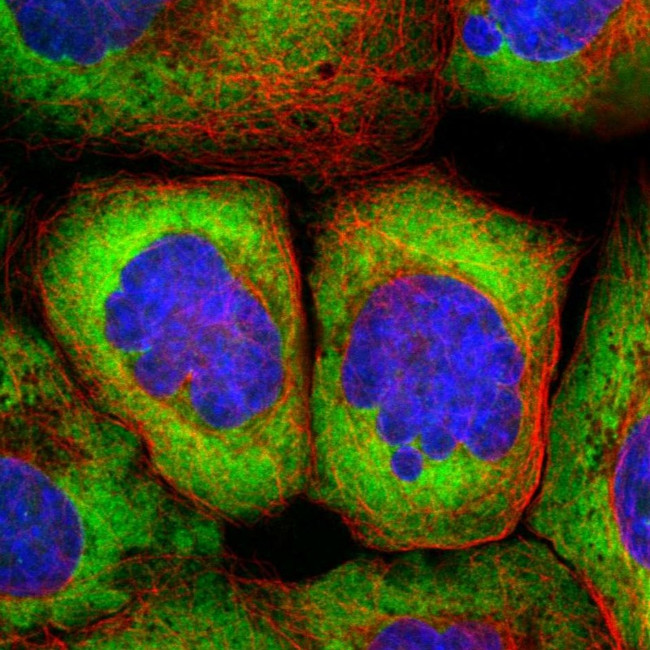 RPS25 Antibody in Immunocytochemistry (ICC/IF)