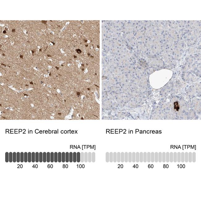 REEP2 Antibody in Immunohistochemistry (IHC)