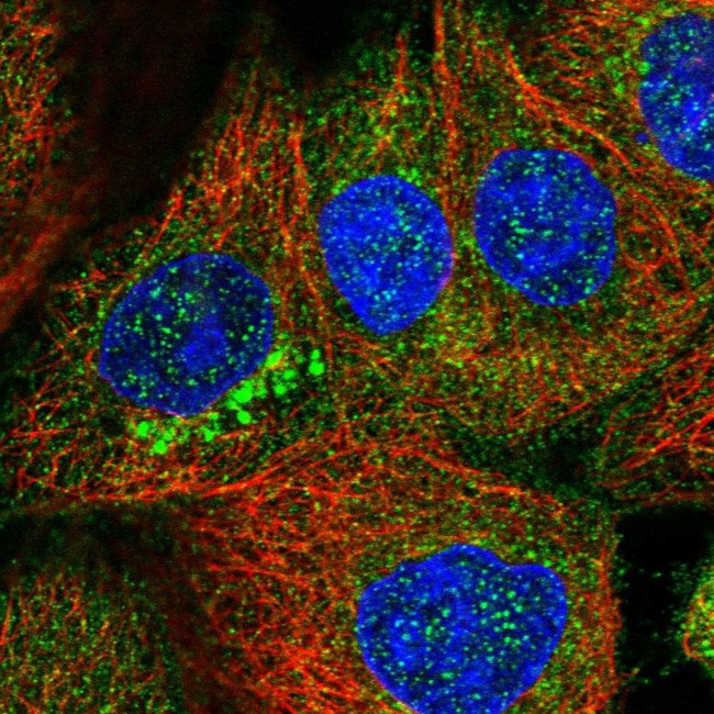 ZDHHC9 Antibody in Immunocytochemistry (ICC/IF)