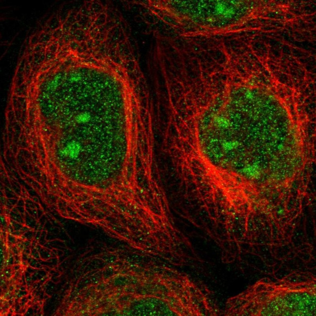 ALG14 Antibody in Immunocytochemistry (ICC/IF)