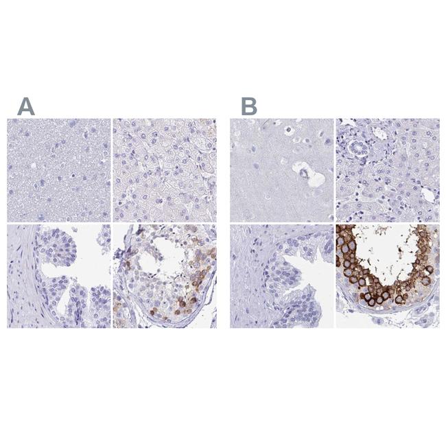 DPEP3 Antibody in Immunohistochemistry (IHC)