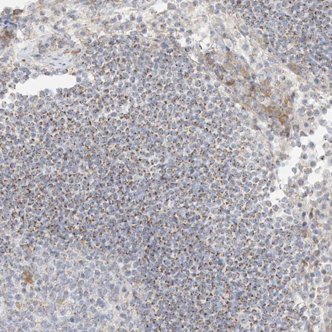 UST Antibody in Immunohistochemistry (Paraffin) (IHC (P))