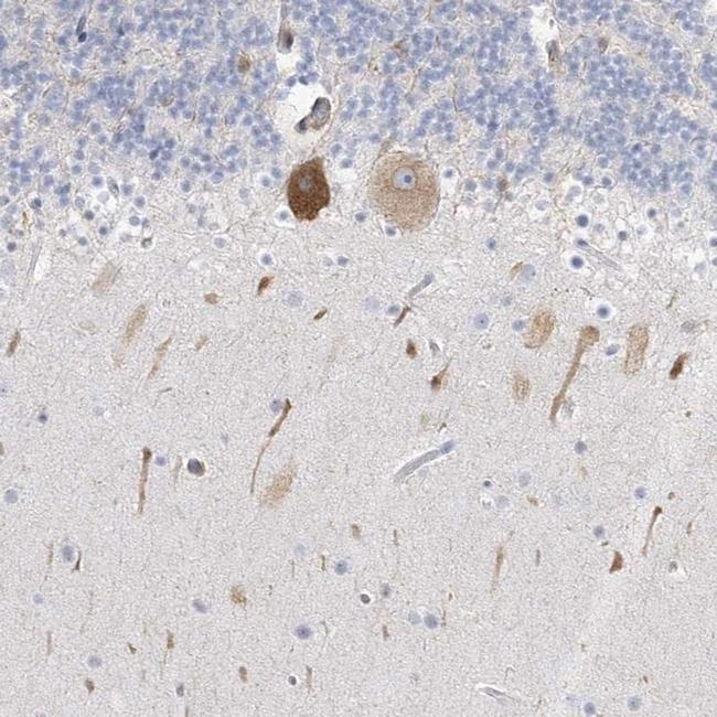 ICMT Antibody in Immunohistochemistry (IHC)