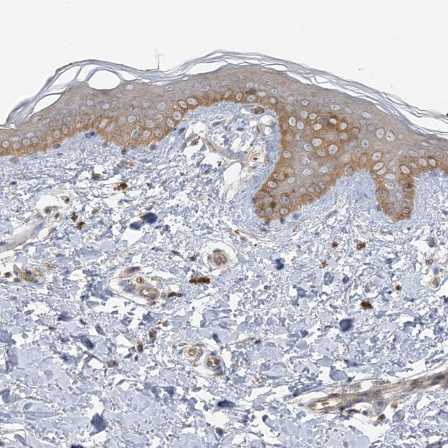 ICMT Antibody in Immunohistochemistry (Paraffin) (IHC (P))