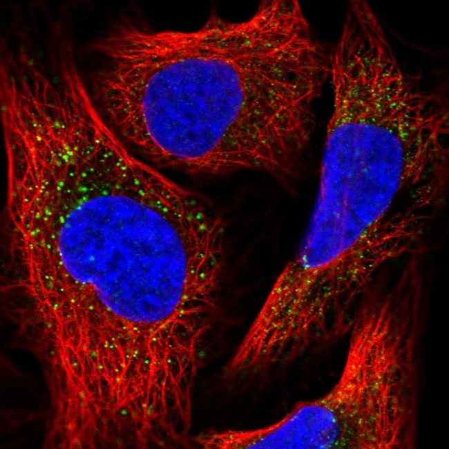 PEX13 Antibody in Immunocytochemistry (ICC/IF)