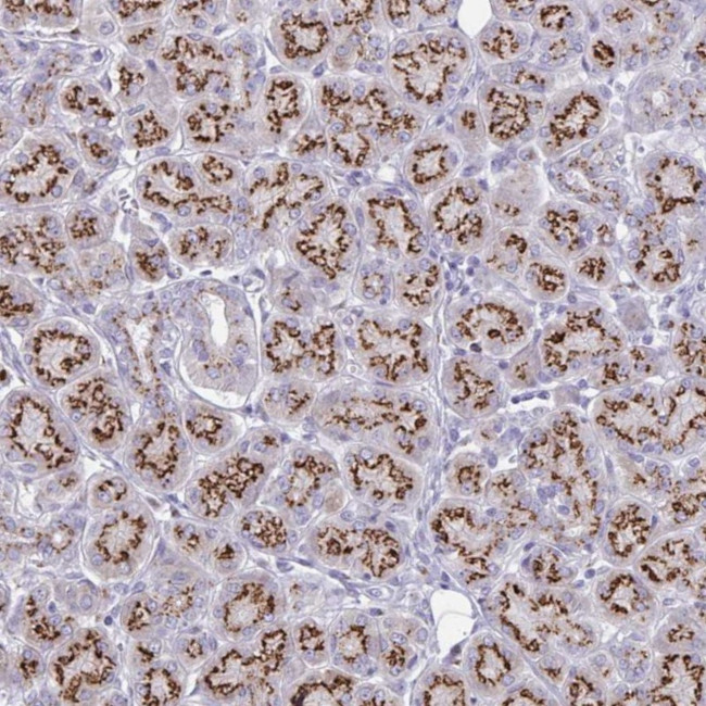 MCFD2 Antibody in Immunohistochemistry (Paraffin) (IHC (P))