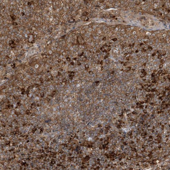 SRP72 Antibody in Immunohistochemistry (IHC)