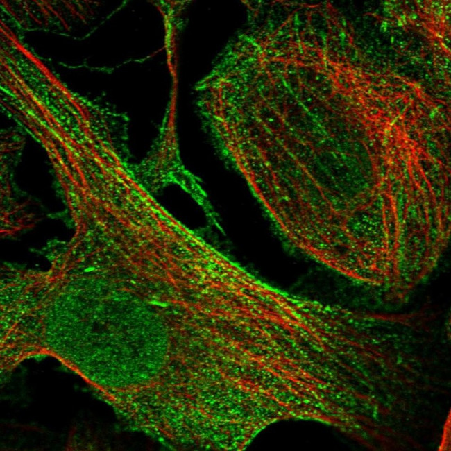 SYNPO Antibody in Immunocytochemistry (ICC/IF)