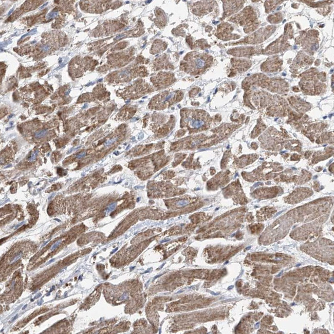 COMMD1 Antibody in Immunohistochemistry (Paraffin) (IHC (P))