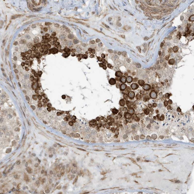 CHCHD4 Antibody in Immunohistochemistry (Paraffin) (IHC (P))