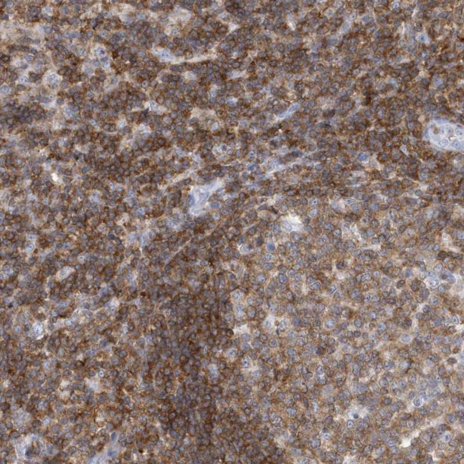 PSD4 Antibody in Immunohistochemistry (Paraffin) (IHC (P))