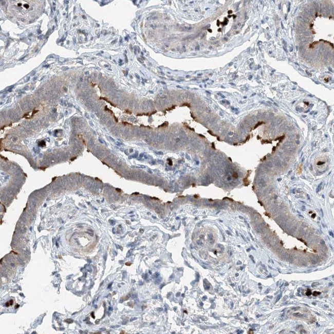 DNAH7 Antibody in Immunohistochemistry (Paraffin) (IHC (P))