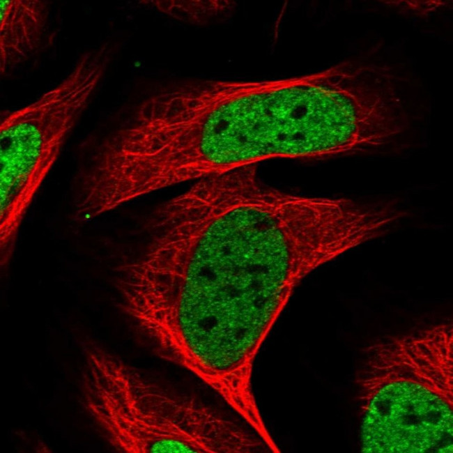 KHSRP Antibody in Immunocytochemistry (ICC/IF)