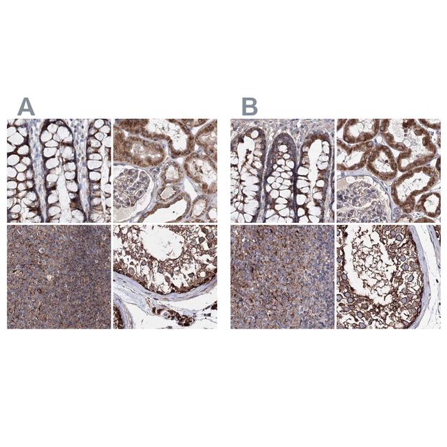 GFM1 Antibody in Immunohistochemistry (IHC)