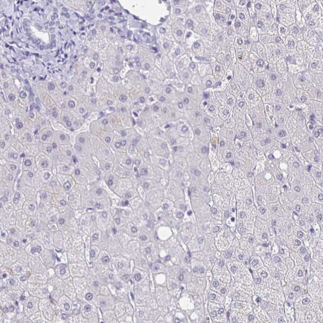 CACNA2D2 Antibody in Immunohistochemistry (Paraffin) (IHC (P))