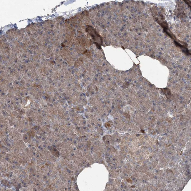 JIP2 Antibody in Immunohistochemistry (Paraffin) (IHC (P))