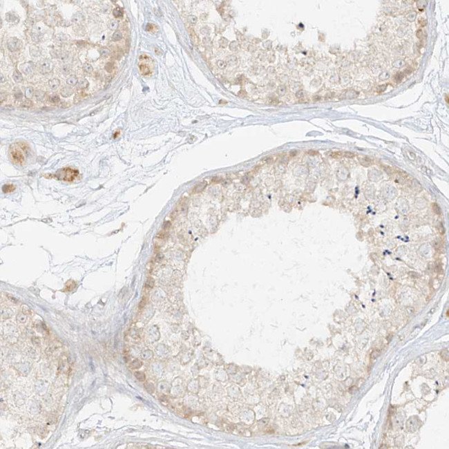 LIPT1 Antibody in Immunohistochemistry (Paraffin) (IHC (P))