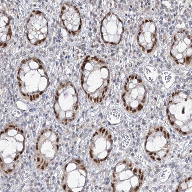 ZC3H8 Antibody in Immunohistochemistry (Paraffin) (IHC (P))