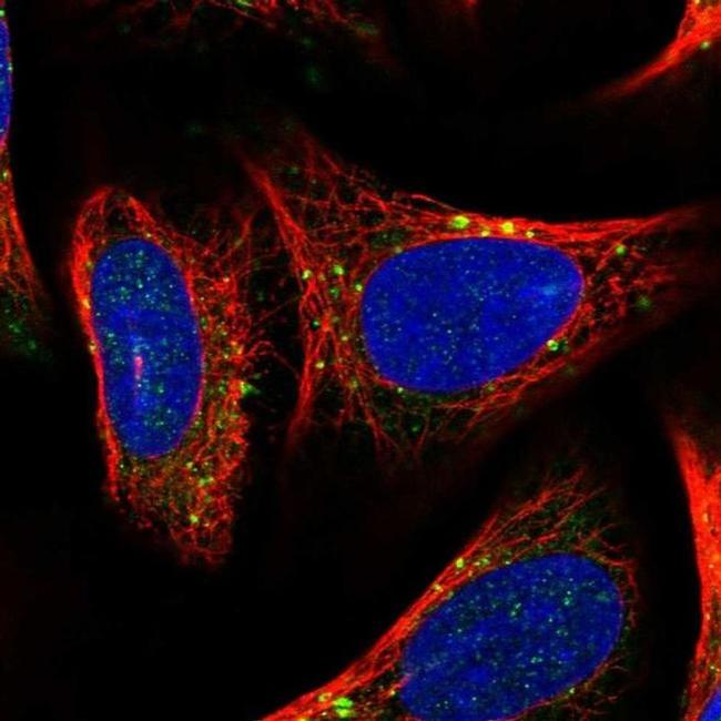 ACAP2 Antibody in Immunocytochemistry (ICC/IF)