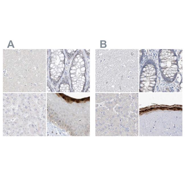 ASPRV1 Antibody in Immunohistochemistry (IHC)