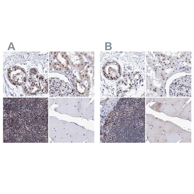 SF3B14 Antibody in Immunohistochemistry (IHC)