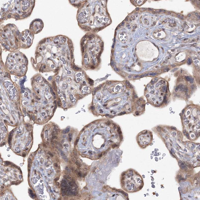 ZFAND6 Antibody in Immunohistochemistry (Paraffin) (IHC (P))